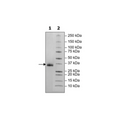 Spike S1 RBD (B.1.617.2, Delta Variant), Avi-His-Tag, Biotin-Labeled (SARS-CoV-2) Recombinant – Figure 1 of 2