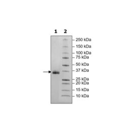 Spike S1 RBD (B.1.617.2, Delta Variant), Avi-His-Tag, Biotin-Labeled (SARS-CoV-2) Recombinant – Figure 1 of 2