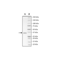 Spike S1 RBD (B.1.617 Variant), Avi-His-Tag (SARS-CoV-2) HiP™ Recombinant – Figure 1 of 2