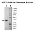 Spike S1 RBD (B.1.618 Variant), Avi-His-Tag (SARS-CoV-2) Recombinant – Figure 1 of 1