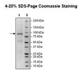 ADAR2 (ADARB1), FLAG-Tag Recombinant – Figure 1 of 1