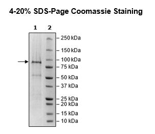 ADAR2 (ADARB1), FLAG-Tag Recombinant – Figure 1 of 1