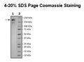 Spike Trimer (S1+S2) (B.1.617.2.1, Delta Plus Variant), His-Tag (SARS-CoV-2) Recombinant – Figure 1 of 1