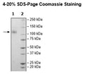 Spike S1 (B.1.617.2.1, Delta Plus Variant) Avi-His-Tag (SARS-CoV-2) Recombinant – Figure 1 of 1