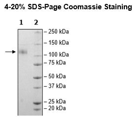 Spike S1 (B.1.617.2.1, Delta Plus Variant) Avi-His-Tag (SARS-CoV-2) Recombinant – Figure 1 of 1