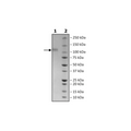 Spike S1 (B.1.617.2.1, Delta Plus Variant) Avi-His-Tag, Biotin-Labeled (SARS-CoV-2) HiP™ Recombinant – Figure 1 of 3