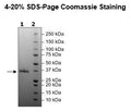 Spike S1 RBD (B.1.617.2.1, Delta Plus Variant), Avi-His-Tag (SARS-CoV-2) HiP™ – Figure 1 of 2