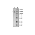 ACE2, Fc Fusion (lgG1), Avi-Tag Recombinant – Figure 1 of 2