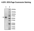 IL2RA, Avi-His-Tag Recombinant – Figure 1 of 1