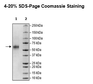 IL2RA, Avi-His-Tag Recombinant – Figure 1 of 1