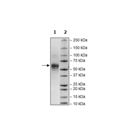 IL2RA, Avi-His-Tag, Biotin-Labeled Recombinant – Figure 1 of 2