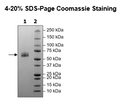 CD161, Fc Fusion (lgG1), Avi-Tag HiP™ Recombinant – Figure 1 of 2