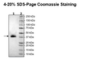 CD2, Avi-His-Tag HiP™ Recombinant – Figure 1 of 2