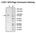 KIR3DS1, Fc-Fusion (lgG1), Avi-Tag Recombinant – Figure 1 of 1