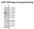 KIR3DS1, Fc Fusion (lgG1), Avi-Tag, Biotin-Labeled Recombinant – Figure 1 of 2
