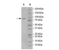 WRN, GST-Tag Recombinant – Figure 1 of 1