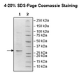 JAK3 (JH2 Domain), His-Tag Recombinant – Figure 1 of 1