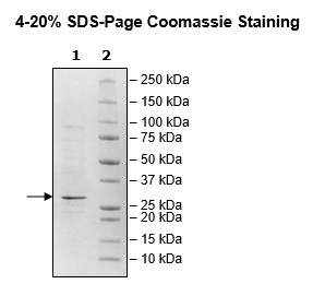 JAK3 (JH2 Domain), His-Tag Recombinant – Figure 1 of 1
