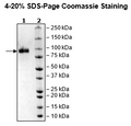IL18R1, Fc Fusion (lgG1), Avi-Tag HiP™ Recombinant – Figure 1 of 2