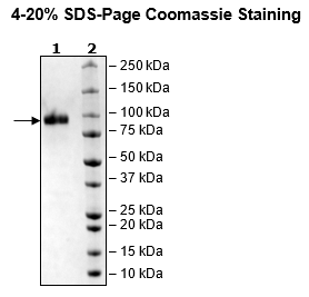 IL18R1, Fc Fusion (lgG1), Avi-Tag HiP™ Recombinant – Figure 1 of 2