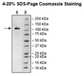 TFRC, Avi-Tag, Fc Fusion (lgG1) Recombinant – Figure 1 of 1