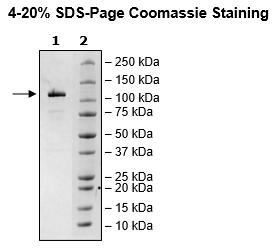 TFRC, Avi-Tag, Fc Fusion (lgG1) Recombinant – Figure 1 of 1