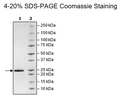 MCL1, His-Tag (Guinea Pig) Recombinant – Figure 1 of 2