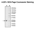 KRAS (G12D), Isoform A, His-Tag, GDP-Loaded Recombinant – Figure 1 of 2