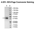 IL2RB, Avi-FLAG-Tag, Biotin-Labeled HiP™ Recombinant – Figure 1 of 3