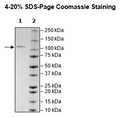 TFRC, Avi-Tag, Fc Fusion(lgG1), Biotin-Labeled Recombinant – Figure 1 of 2