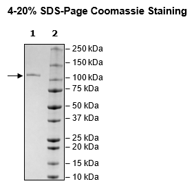 TFRC, Avi-Tag, Fc Fusion(lgG1), Biotin-Labeled Recombinant – Figure 1 of 2