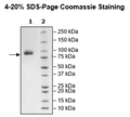 IL23R, Fc-Fusion (IgG1), Avi-Tag HiP™ Recombinant – Figure 1 of 2