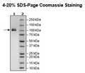 IL23R, Fc Fusion (lgG1), Avi-Tag, Biotin-Labeled HiP™ Recombinant – Figure 1 of 3