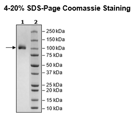 IL23R, Fc Fusion (lgG1), Avi-Tag, Biotin-Labeled HiP™ Recombinant – Figure 1 of 3
