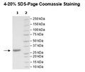 3CL Protease (B.1.1.529, Omicron Variant), (SARS-CoV-2) Recombinant – Figure 1 of 2