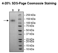 Spike S1 (B.1.1.529 BA.1, Omicron Variant), Avi-His-Tag, (SARS-CoV-2) Recombinant – Figure 1 of 1