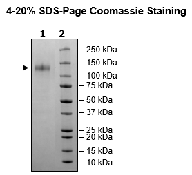 Spike S1 (B.1.1.529 BA.1, Omicron Variant), Avi-His-Tag, (SARS-CoV-2) Recombinant – Figure 1 of 1