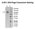 Spike S1 (B.1.1.529 BA.1, Omicron Variant), Avi-His-Tag, Biotin-Labeled (SARS-CoV-2) Recombinant – Figure 1 of 2