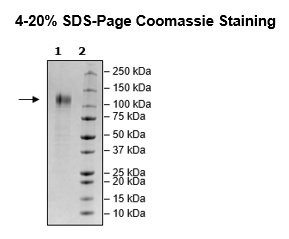 Spike S1 (B.1.1.529 BA.1, Omicron Variant), Avi-His-Tag, Biotin-Labeled (SARS-CoV-2) Recombinant – Figure 1 of 2