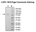 IL12RB1, Avi-His-Tag Recombinant – Figure 1 of 1