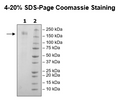 Spike Trimer (S1+S2) (B.1.1.529 BA.1, Omicron Variant), His-Tag (SARS-CoV-2) Recombinant – Figure 1 of 1