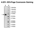 Trop2 (88-274), Fc Fusion (lgG1), Avi-Tag, Biotin-Labeled Recombinant – Figure 1 of 2