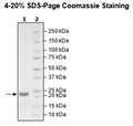 KRAS (G12V), Isoform B, His-Tag, GDP-Loaded Recombinant – Figure 1 of 2