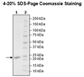 KRAS (G12V), Isoform B, His-Tag, GppNHp-Loaded Recombinant – Figure 1 of 2