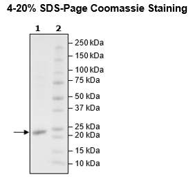 KRAS (G12V), Isoform B, His-Tag, GppNHp-Loaded Recombinant – Figure 1 of 2