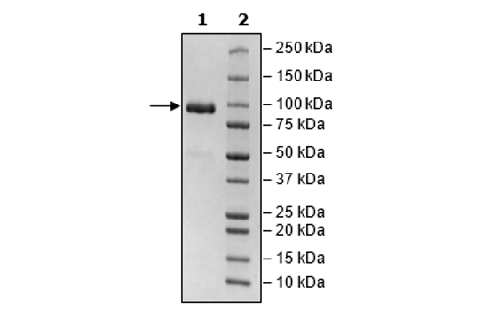 DDR2, Fc Fusion (lgG1), Avi-Tag, Biotin Labeled Recombinant – Figure 1 of 2