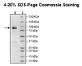 DDR1, Fc Fusion (lgG1), Avi-Tag, Biotin-Labeled Recombinant – Figure 1 of 2