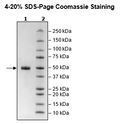 Cathepsin D, His-Tag Recombinant – Figure 1 of 1