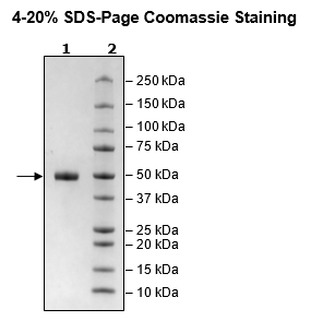 Cathepsin D, His-Tag Recombinant – Figure 1 of 1