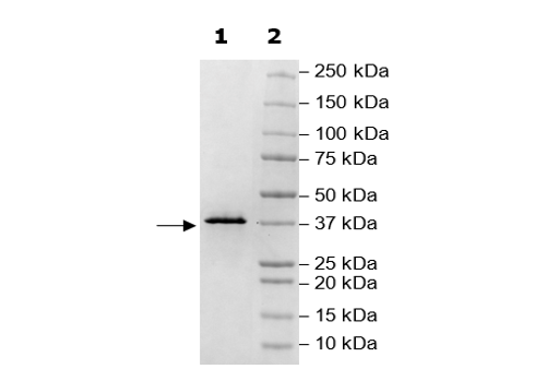 VP39, His-Tag, (Vaccinia Virus) Recombinant – Figure 1 of 1